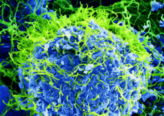 Ebola-Virus